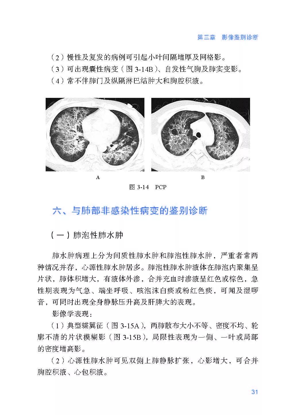 全球视角下的新冠型肺炎最新动态与应对策略进展